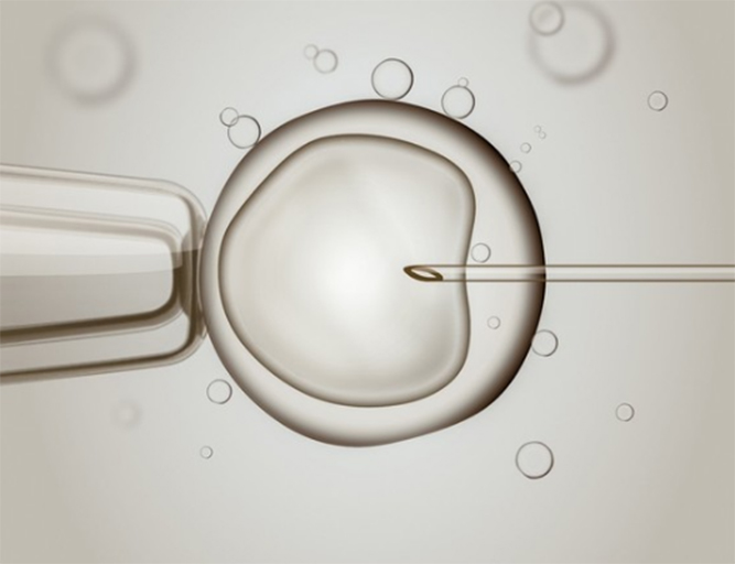做一代试管鲜胚移植后的注意事项有